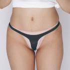 2way�X�g���b�`�҃����O�t�����|�P�b�g�t���n�[�t�o�b�N�@�u���b�N