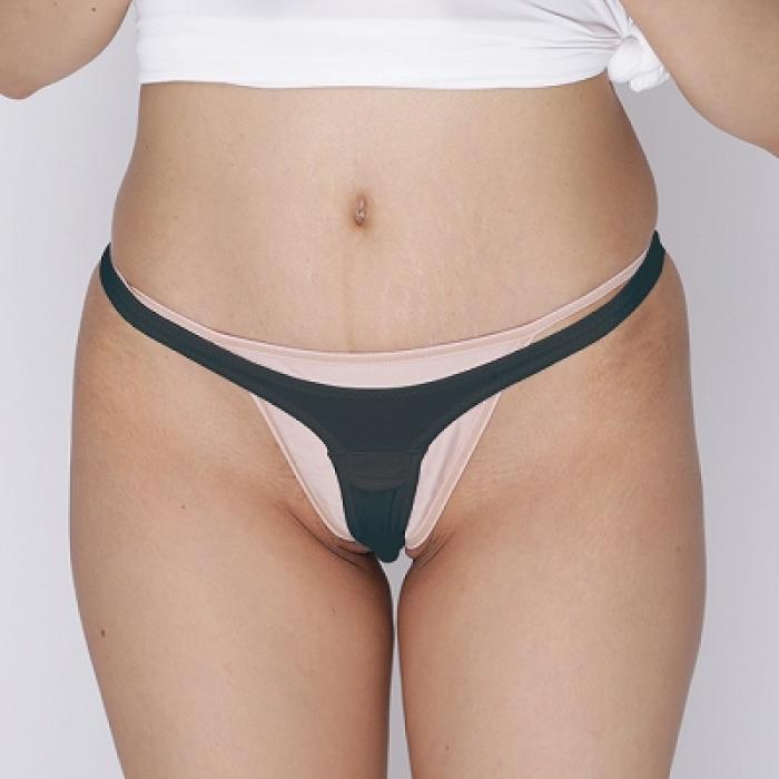 2way�X�g���b�`�҃����O�t�����|�P�b�g�t���n�[�t�o�b�N�@�u���b�N[28385]